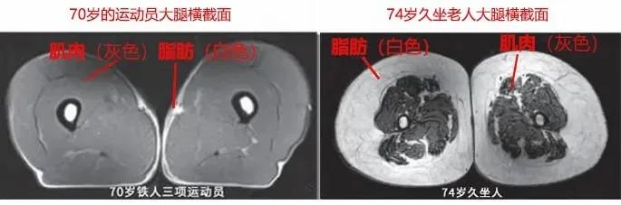 運(yùn)動(dòng)是加速衰老，還是延緩衰老？真相揭開(kāi)